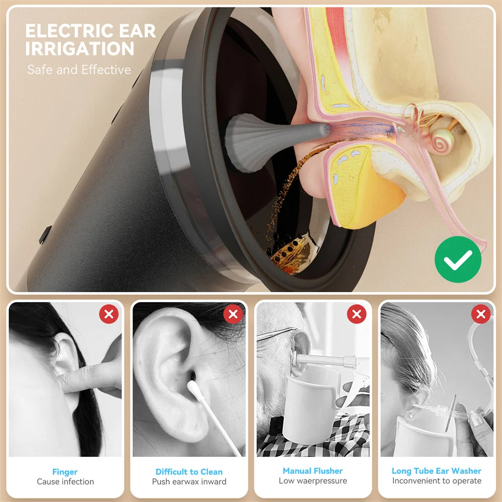 Electric Ear Wax Removal System – Water-Powered Ear Cleaner with Irrigation Flusher