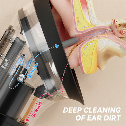 Electric Ear Wax Removal System – Water-Powered Ear Cleaner with Irrigation Flusher